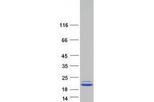 Validation with Western Blot
