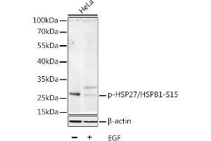 Western blot analysis of extracts of HeLa cells, using Phospho-HSP27/HSPB1-S15 antibody  at 1:1000 dilution. (HSP27 anticorps  (pSer15))