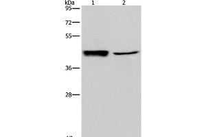 Western Blot analysis of Human hepatocellular carcinoma tissue and A549 cell using GRPR Polyclonal Antibody at dilution of 1:300