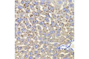 Immunohistochemistry of paraffin-embedded mouse liver using HSD17B13 Antibody. (HSD17B13 anticorps  (AA 20-300))