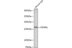 Western blot analysis of extracts of Mouse eye, using CF antibody (ABIN7266399) at 1:1000 dilution. (CFAP61 anticorps)