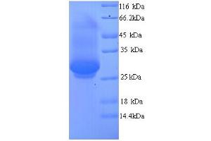 SDS-PAGE (SDS) image for Dynamin 1 (DNM1) (AA 2-245), (partial) protein (His tag) (ABIN5713404)