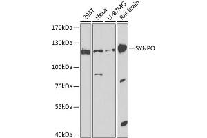 Western blot analysis of extracts of various cell lines, using SYNPO antibody (ABIN6128791, ABIN6148774, ABIN6148776 and ABIN6224561) at 1:1000 dilution. (SYNPO anticorps  (AA 1-260))