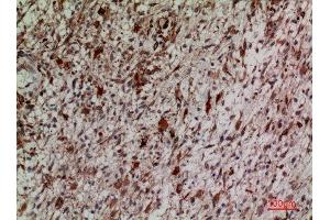 Immunohistochemistry (IHC) analysis of paraffin-embedded Human Brain, antibody was diluted at 1:100.