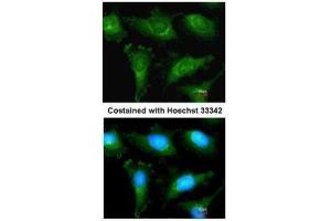 ICC/IF Image Immunofluorescence analysis of methanol-fixed HeLa, using alpha Actinin 2, antibody at 1:200 dilution.