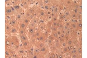 Detection of CTH in Human Liver Tissue using Polyclonal Antibody to Cystathionine (CTH)