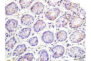Formalin-fixed and paraffin embedded rat colon labeled with Anti-NKG2A Polyclonal Antibody, Unconjugated (ABIN739875) at 1:200 followed by conjugation to the secondary antibody