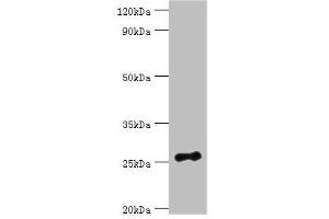 Western blot All lanes: Vesicle-associated membrane protein-associated protein B/C antibody at 3 μg/mL + Mouse brain tissue Secondary Goat polyclonal to rabbit IgG at 1/10000 dilution Predicted band size: 28, 12 kDa Observed band size: 28 kDa (VAPB anticorps  (AA 10-222))