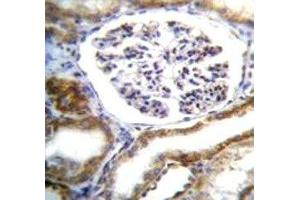 IFT88 antibody immunohistochemistry analysis in formalin fixed and paraffin embedded human kidney tissue.