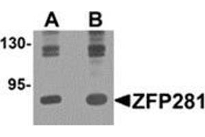 Western blot analysis of ZFP281 in A-20 cell lysate with ZFP281 antibody at (A) 0. (ZNF281 anticorps  (C-Term))