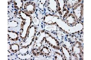 Immunohistochemical staining of paraffin-embedded prostate tissue using anti-SATB1mouse monoclonal antibody. (SATB1 anticorps)
