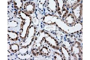 Immunohistochemical staining of paraffin-embedded prostate tissue using anti-SATB1mouse monoclonal antibody.