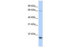MUC1 antibody used at 1 ug/ml to detect target protein. (MUC1 anticorps  (Middle Region))
