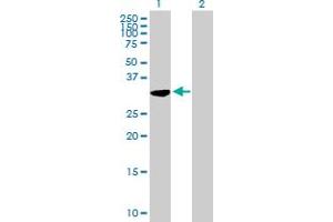 Western Blot analysis of C21orf59 expression in transfected 293T cell line by C21orf59 MaxPab polyclonal antibody. (C21orf59 anticorps  (AA 1-290))