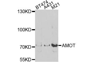 Western blot analysis of extracts of various cell lines, using AMOT antibody (ABIN5975255) at 1/1000 dilution.