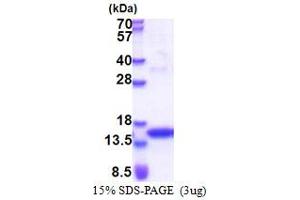 SDS-PAGE (SDS) image for Janus Kinase 2 (JAK2) (AA 1014-1132) protein (His tag) (ABIN5853450)