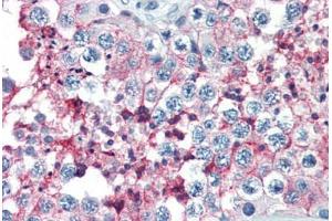 Human Testis (formalin-fixed, paraffin-embedded) stained with BSG antibody ABIN396957 at 10 ug/ml followed by biotinylated anti-mouse IgG secondary antibody ABIN481714, alkaline phosphatase-streptavidin and chromogen. (CD147 anticorps)