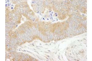 Immunohistochemistry (IHC) image for anti-eIF2 alpha/eif2s1 (C-Term) antibody (ABIN7448959) (eIF2 alpha/eif2s1 (C-Term) anticorps)