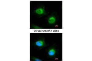 anti-Cofilin 2 (CFL2) (C-Term) antibody