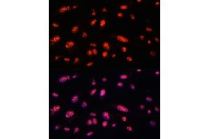 Immunofluorescence analysis of U-2 OS cells using ILF3 antibody (ABIN3023309, ABIN3023310, ABIN3023311 and ABIN6219571) at dilution of 1:100. (Interleukin enhancer-binding factor 3 (ILF3) (AA 1-270) anticorps)