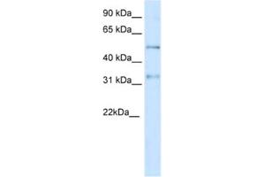 Western Blotting (WB) image for anti-Potassium Voltage-Gated Channel, Shaker-Related Subfamily, beta Member 2 (KCNAB2) antibody (ABIN2461571)