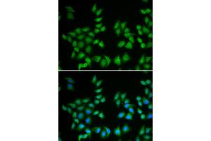 Immunofluorescence analysis of A549 cell using EIF6 antibody. (EIF6 anticorps)