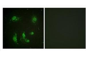Immunofluorescence analysis of HeLa cells, using Survivin Antibody . (Survivin anticorps)
