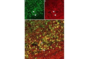 Hm1a toxin co-localizes with Anti-SCN1A (NaV1. (Hm1a Toxin Peptide)