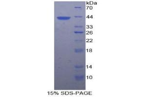 SDS-PAGE analysis of Rat Platelet Factor 4 Protein.