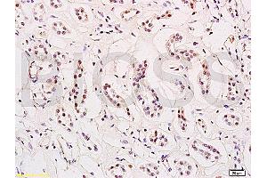 Formalin-fixed and paraffin embedded human kidney tissue labeled with Anti-HES-1 Polyclonal Antibody, Unconjugated (ABIN682393) at 1:200 followed by conjugation to the secondary antibody and DAB staining (HES1 anticorps  (AA 41-150))