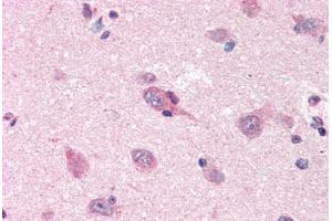Human Brain, Cortex (formalin-fixed, paraffin-embedded) stained with APP antibody ABIN364364 at 2.