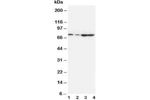 Western blot testing of PCSK9 antibody and Lane 1:  A549;  2: HeLa;  3: U87;  4: PANC cell lysate