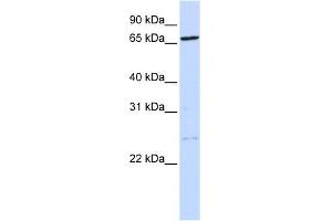 TLK1 antibody used at 1 ug/ml to detect target protein. (TLK1 anticorps  (N-Term))