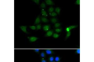Immunofluorescence analysis of MCF-7 cells using TAT Polyclonal Antibody (Tat anticorps)