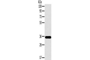 Western Blotting (WB) image for anti-OTU Domain, Ubiquitin Aldehyde Binding 1 (OTUB1) antibody (ABIN2430593) (OTUB1 anticorps)