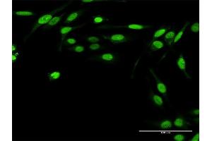 Immunofluorescence of purified MaxPab antibody to TWIST2 on HeLa cell. (TWIST2 anticorps  (AA 1-160))