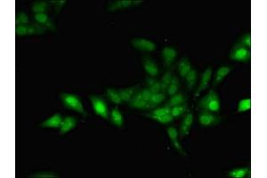 Immunofluorescent analysis of Hela cells using ABIN7153777 at dilution of 1:100 and Alexa Fluor 488-congugated AffiniPure Goat Anti-Rabbit IgG(H+L)