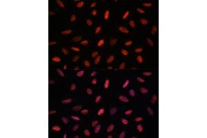 anti-AT Rich Interactive Domain 1B (SWI1-Like) (ARID1B) (AA 400-650) antibody