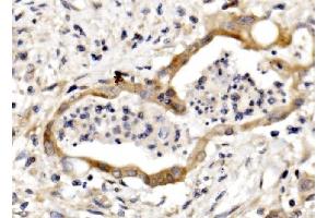 IHC analysis of Nectin 3/NECTIN3 using anti-Nectin 3/NECTIN3 antibody (ABIN7602666). (nectin-3 anticorps  (AA 92-296))