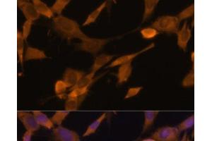 Immunofluorescence analysis of NIH-3T3 cells using UBQLN2 Polyclonal Antibody at dilution of 1:100 (40x lens).