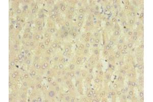 Immunohistochemistry of paraffin-embedded human liver tissue using ABIN7155881 at dilution of 1:100 (HOMER2 anticorps  (AA 1-343))