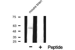 Western blot analysis of Cytochrome P450 17A1 expression in mouse tissue. (CYP17A1 anticorps  (Internal Region))