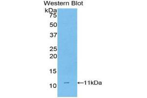 Western blot analysis of the recombinant protein. (CD3D anticorps  (AA 22-106))