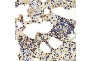 Immunohistochemistry of paraffin-embedded rat lung using DDX5 antibody.