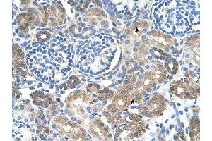 SLC38A4 antibody was used for immunohistochemistry at a concentration of 4-8 ug/ml to stain Epithelial cells of renal tubule (arrows) in Human Kidney. (SLC38A4 anticorps  (Middle Region))