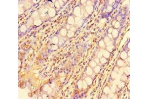 Immunohistochemistry of paraffin-embedded human colon tissue using ABIN7175986 at dilution of 1:100