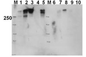 Image no. 1 for anti-Protein Kinase, DNA-Activated, Catalytic Polypeptide (PRKDC) (Thr2609) antibody (ABIN401263) (PRKDC anticorps  (Thr2609))