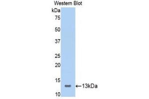 Western Blotting (WB) image for anti-Inducible T-Cell Co-Stimulator (ICOS) (AA 39-133) antibody (ABIN1173559) (ICOS anticorps  (AA 39-133))