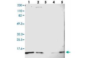 Western blot analysis of Lane 1: RT-4, Lane 2: U-251 MG, Lane 3: Human Plasma, Lane 4: Liver, Lane 5: Tonsil with DYNLT3 polyclonal antibody .