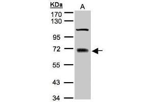 WB Image Sample(30 μg of whole cell lysate) A:A431 7. (TRIM25 anticorps)